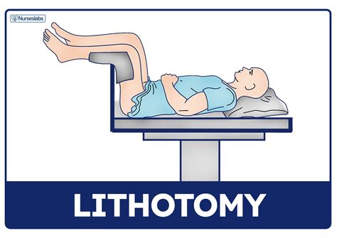 截刀臥位|截石位 lithotomy position